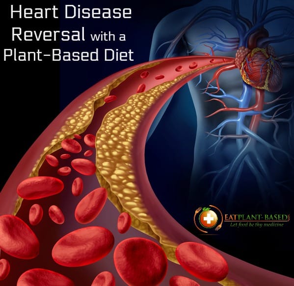 high fatplant based diet reverse heart disease
