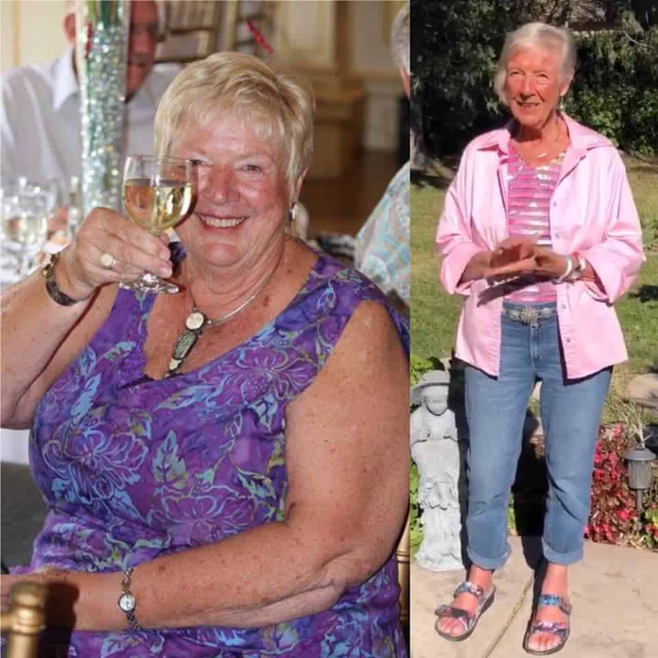 esther loveridge before and after photos