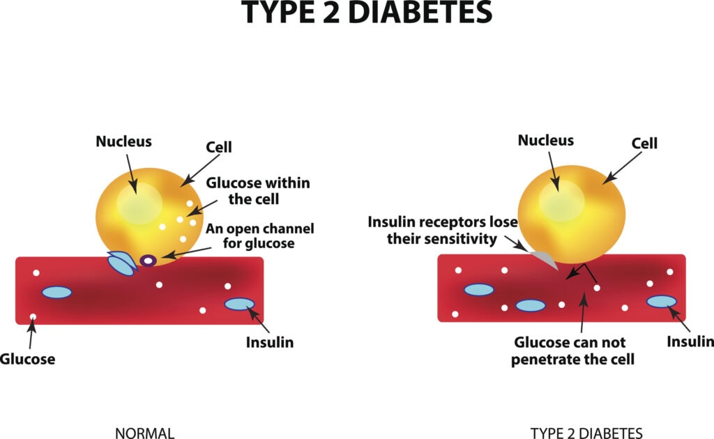 Graphic showing the absorption of glucose by the cell. Type 2 diabetes. Increase and decrease blood sugar. 