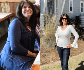 anita roussel's before and after photos.